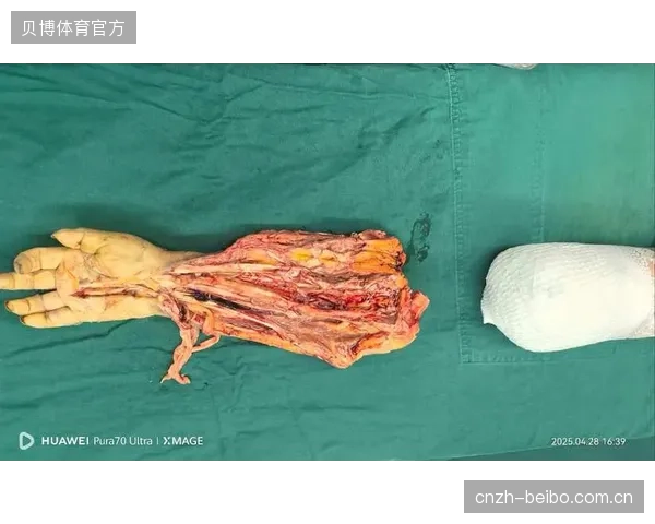 为何针对筋膜炎、横纹肌溶解症等新型运动伤害的保险理赔屡遭驳回？